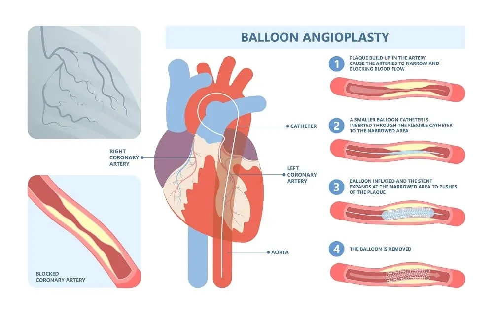 Diagnostic procedure