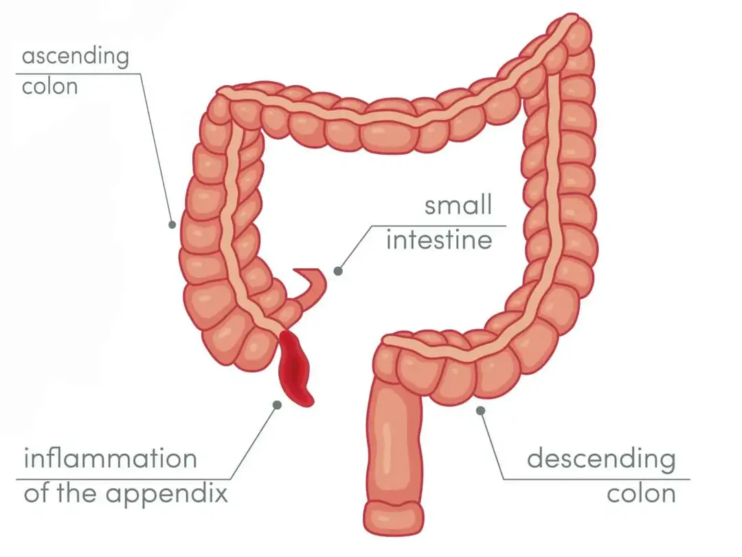 Diagnostic procedure