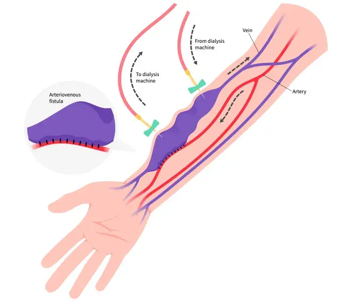 Diagnostic procedure