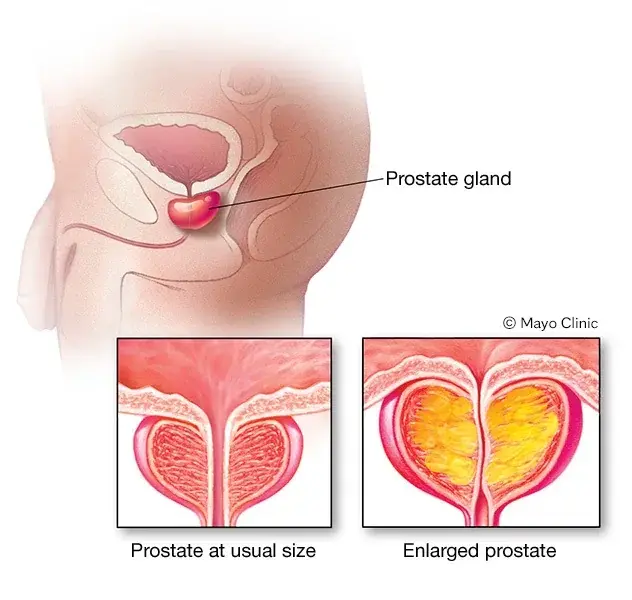 Condition illustration