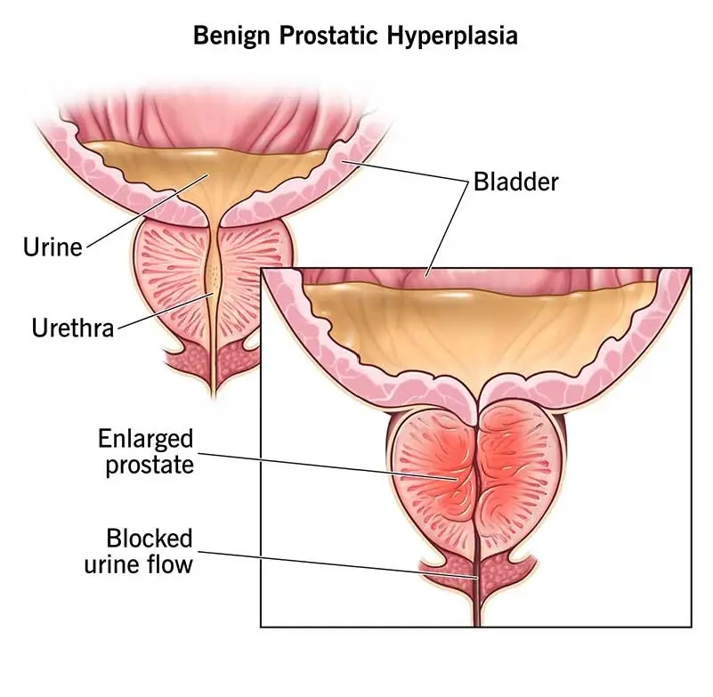 Diagnostic procedure