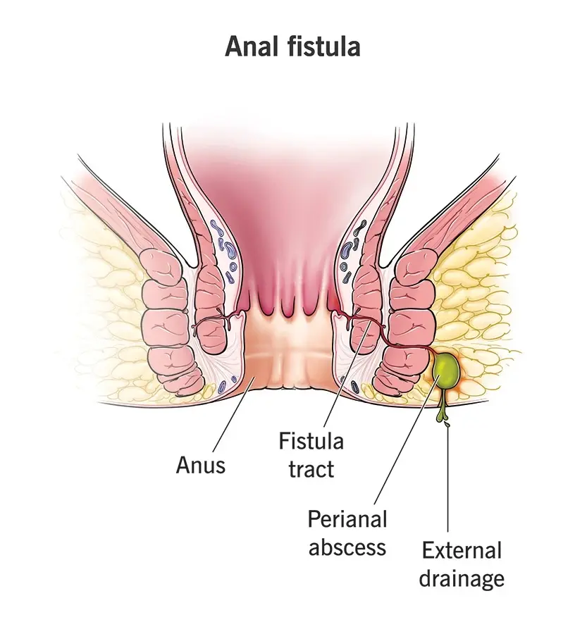Condition illustration