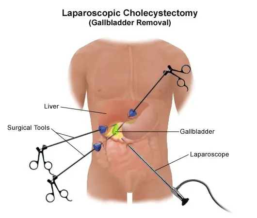 Diagnostic procedure