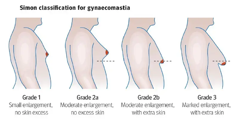 Condition illustration