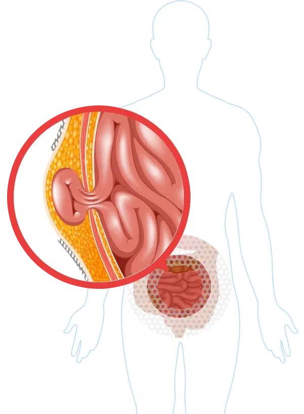 Condition illustration