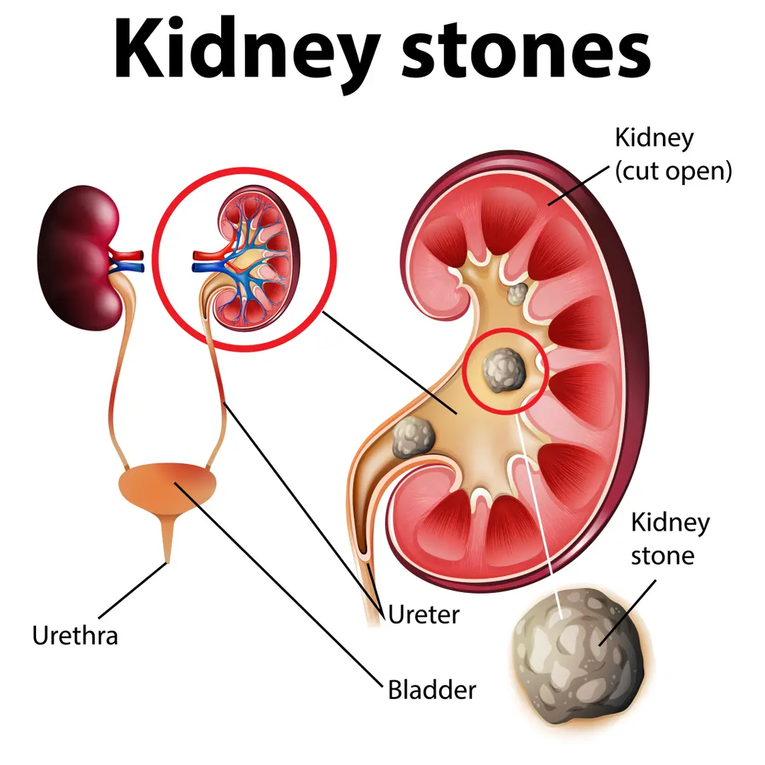 Condition illustration
