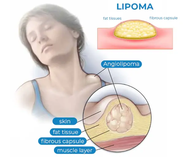 Diagnostic procedure