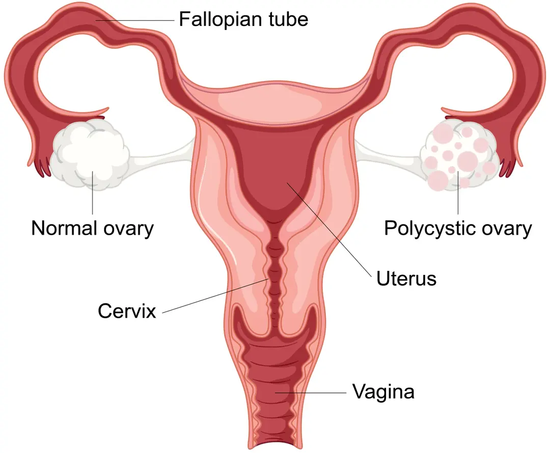 Condition illustration