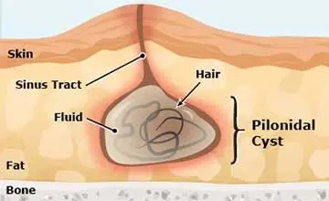 Condition illustration