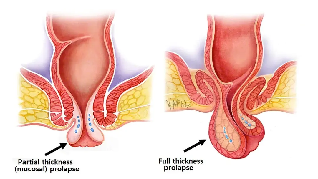 Condition illustration
