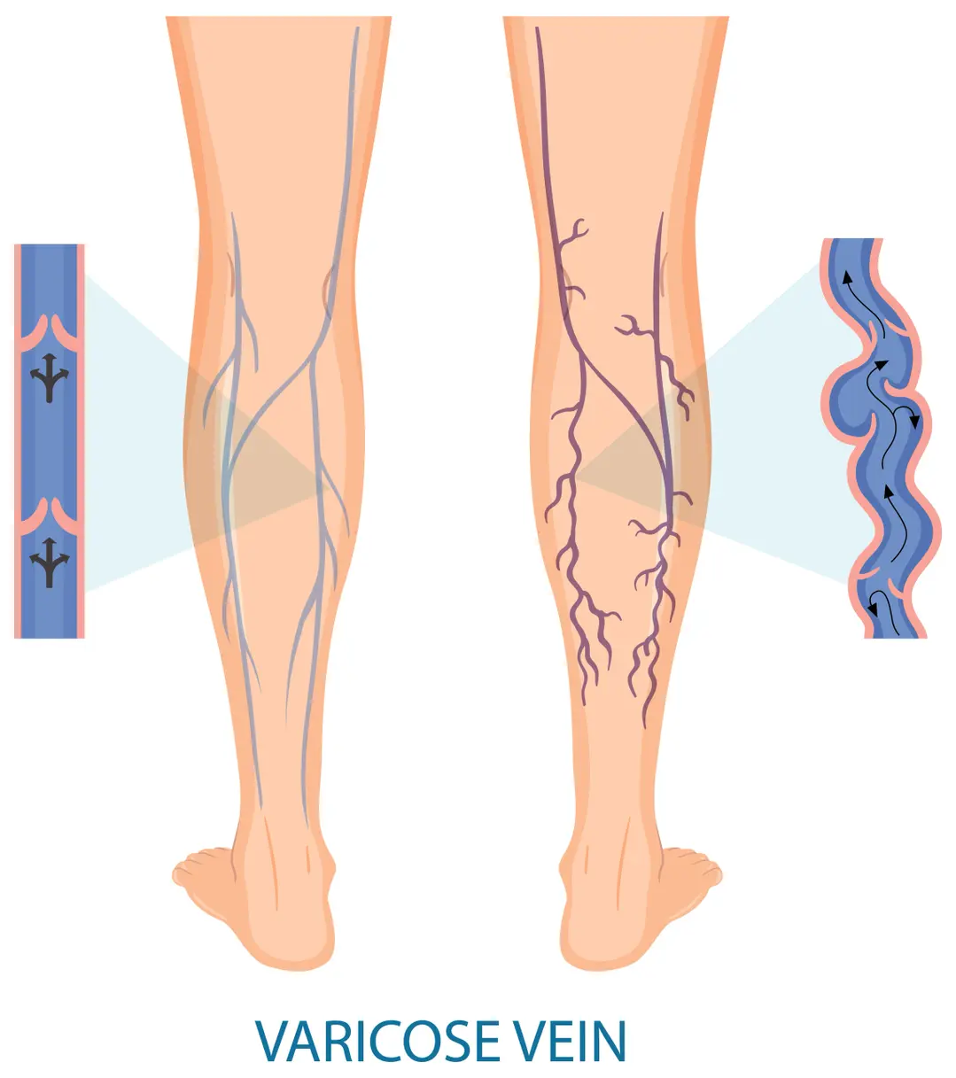 Condition illustration