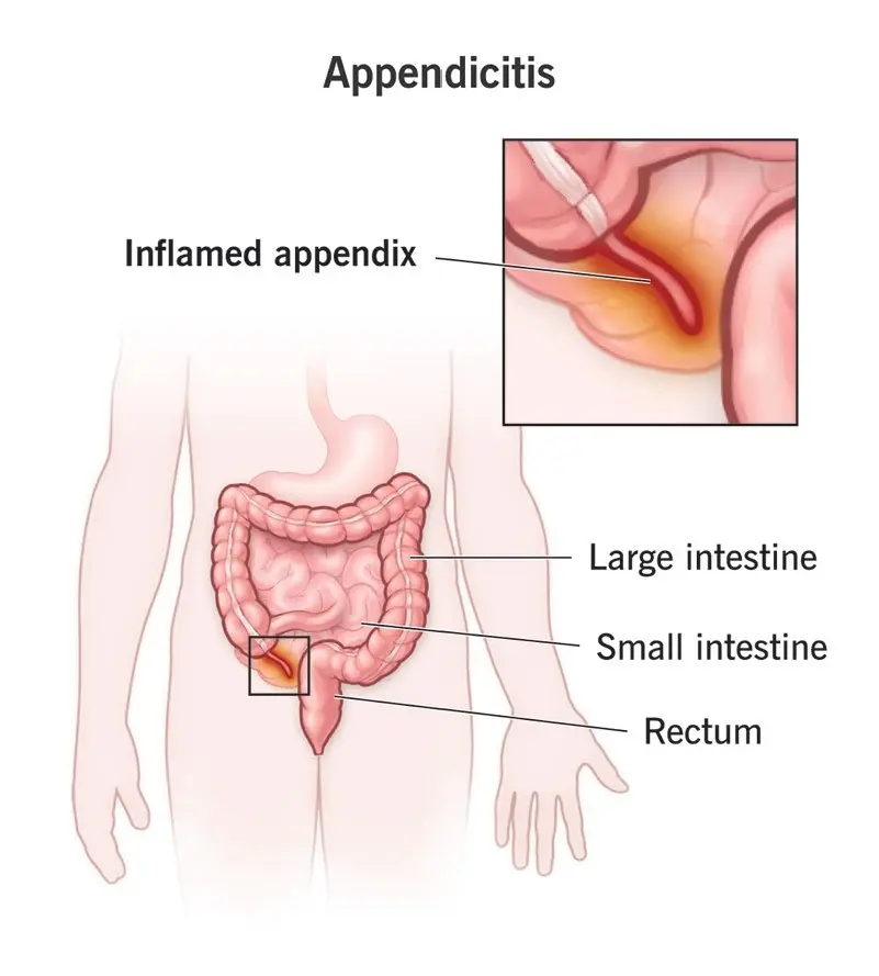 Condition illustration