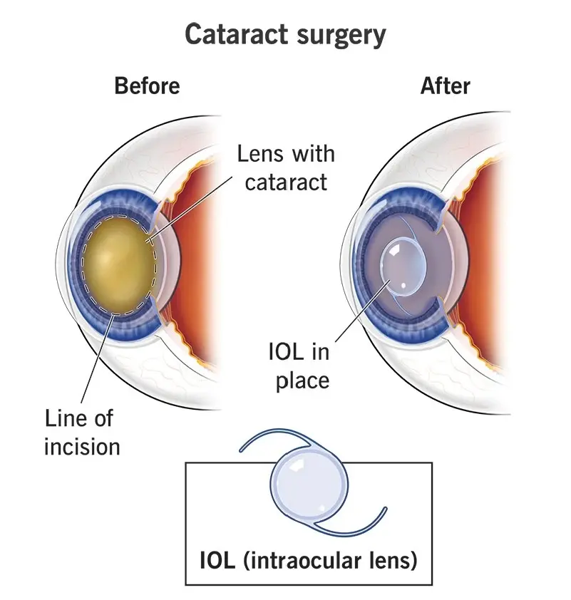 Condition illustration