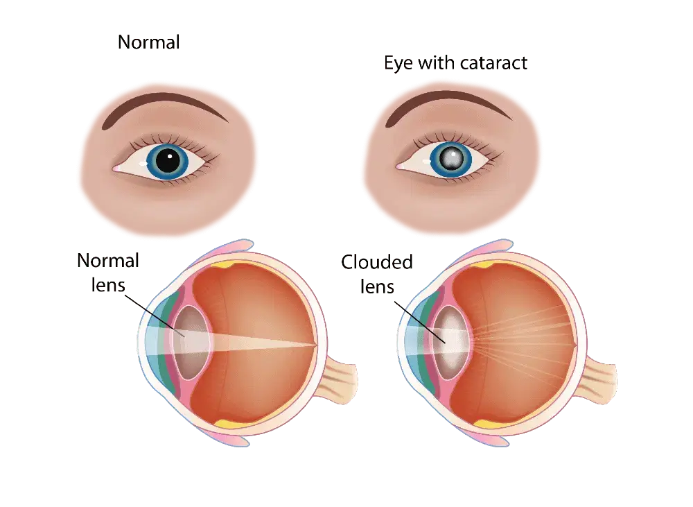 Diagnostic procedure