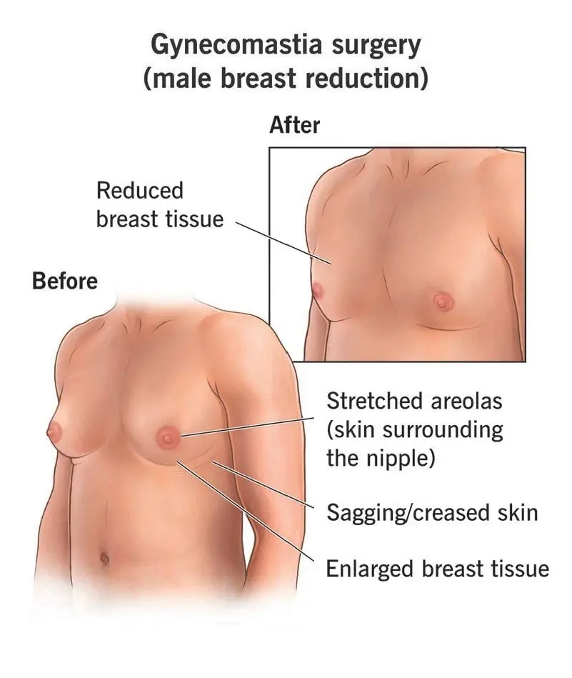 Diagnostic procedure