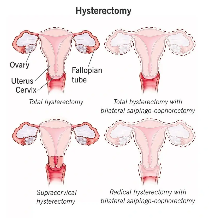 Condition illustration