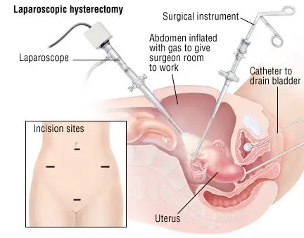 Diagnostic procedure