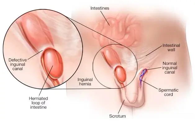Diagnostic procedure