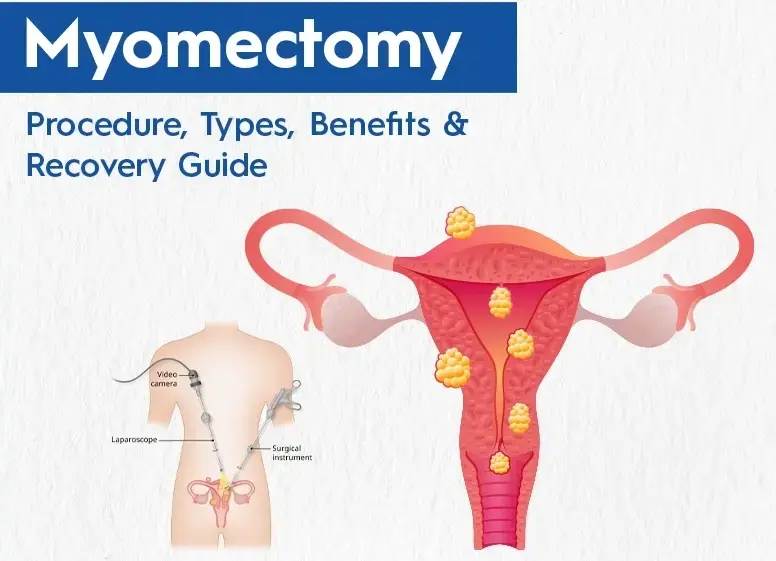 Condition illustration