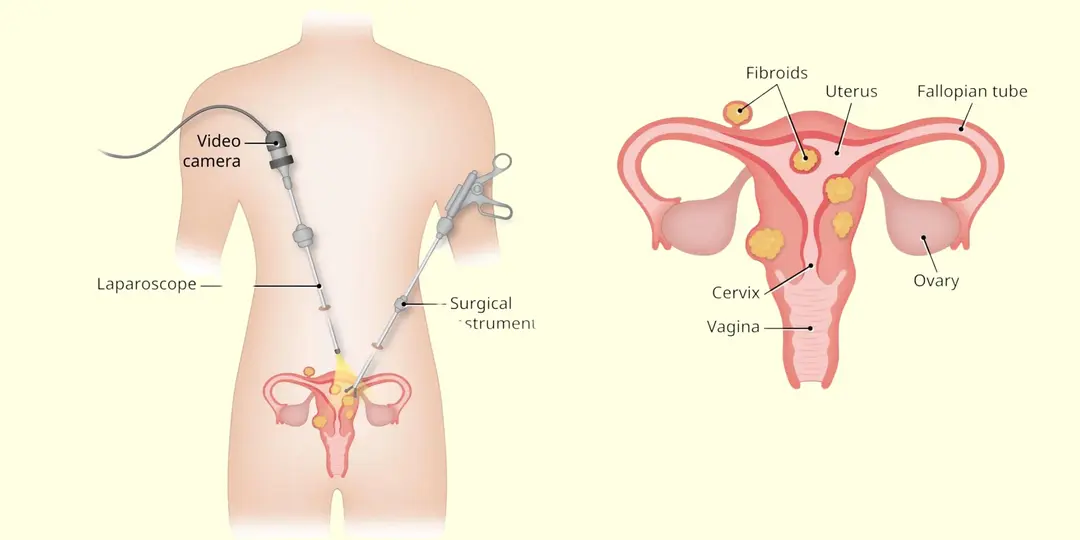 Diagnostic procedure