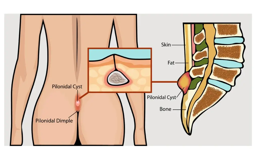 Diagnostic procedure