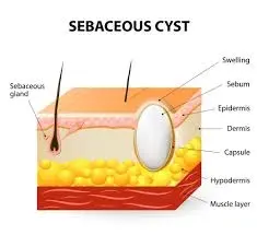 Condition illustration