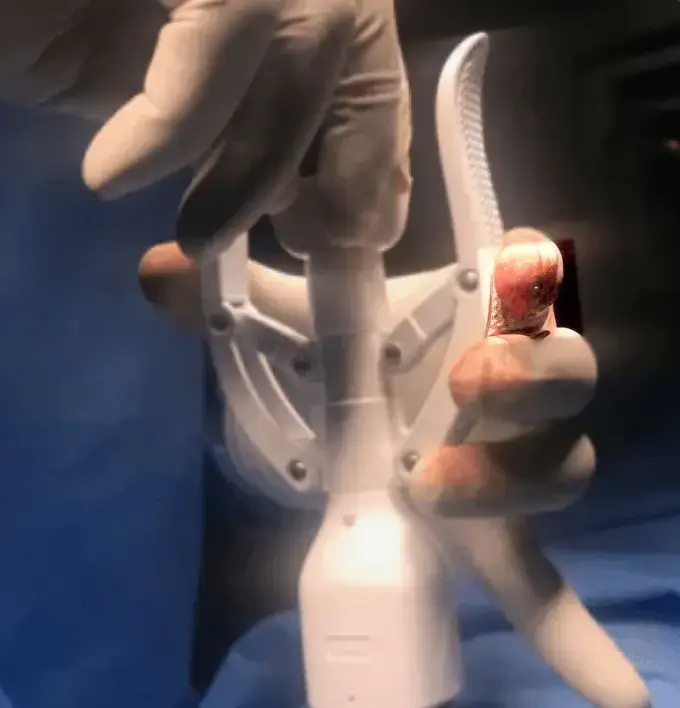 Condition illustration