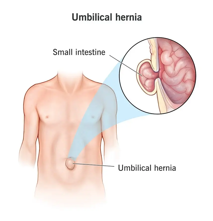 Diagnostic procedure