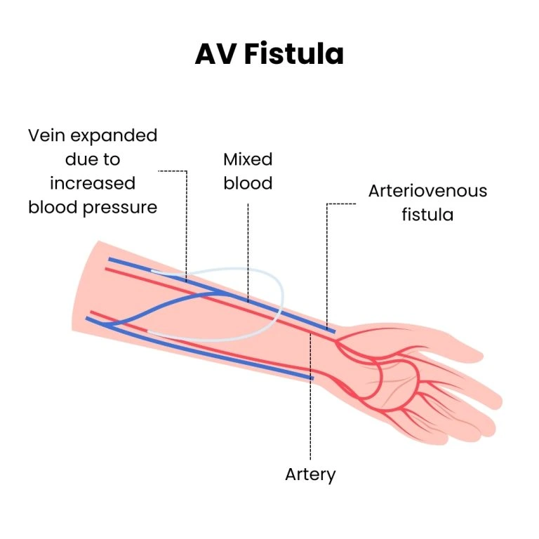 Condition illustration