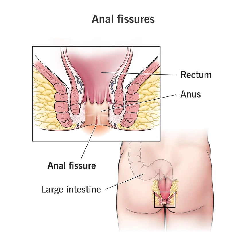 Condition illustration