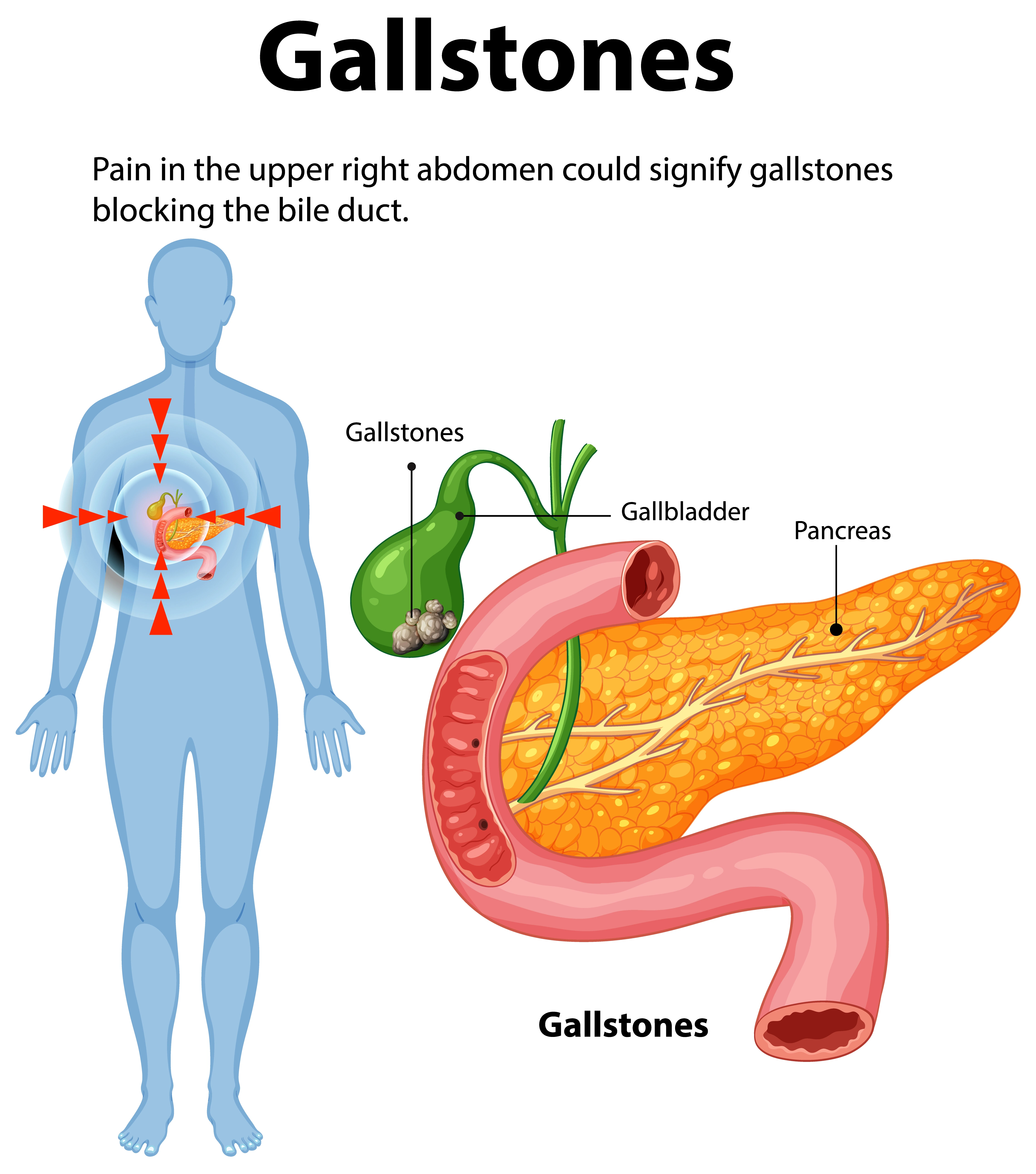 Condition illustration