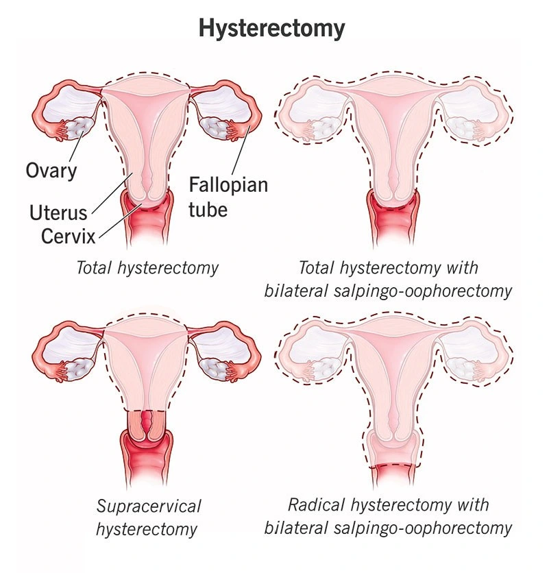 Condition illustration