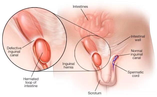 Diagnostic procedure