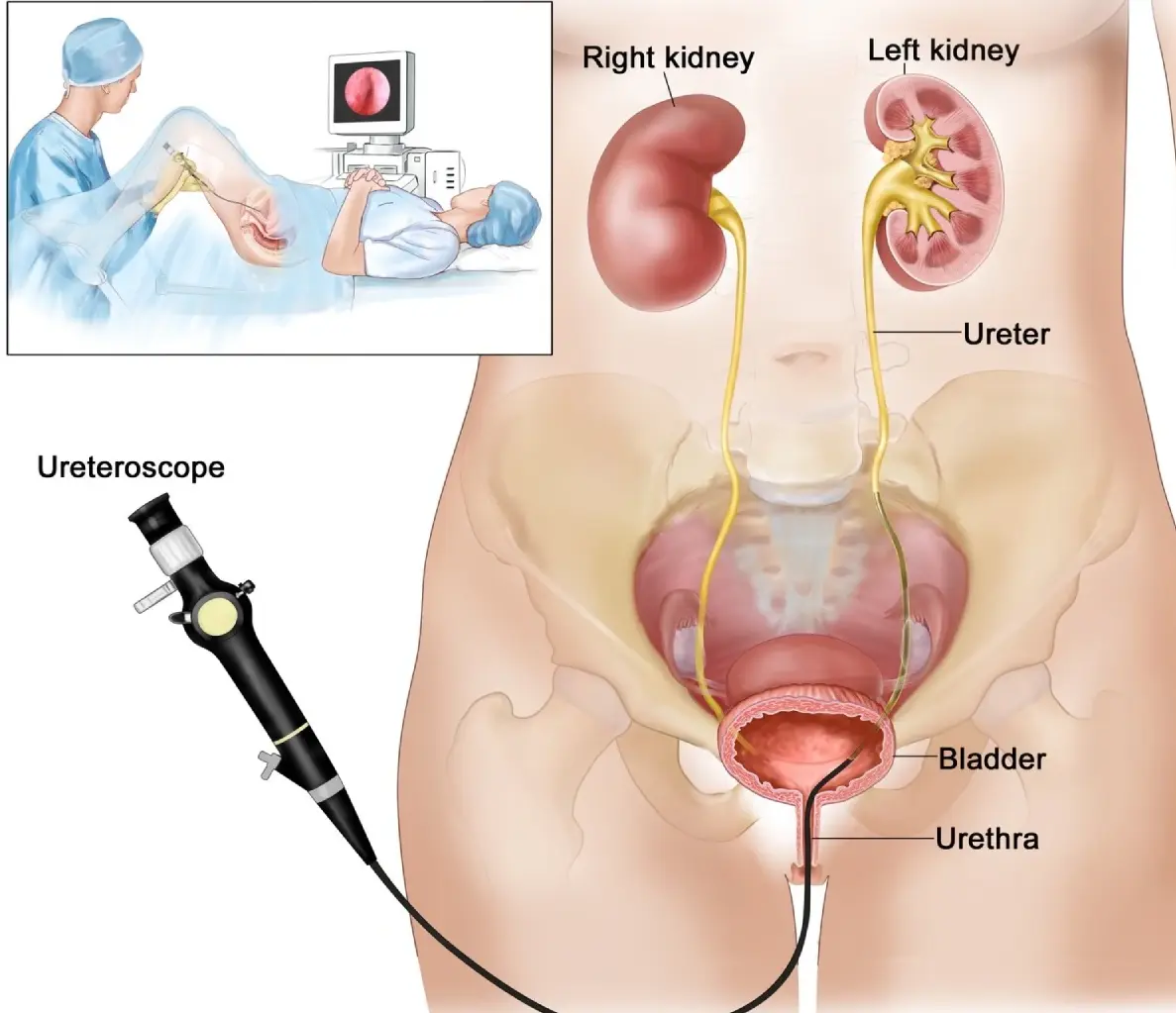 Diagnostic procedure