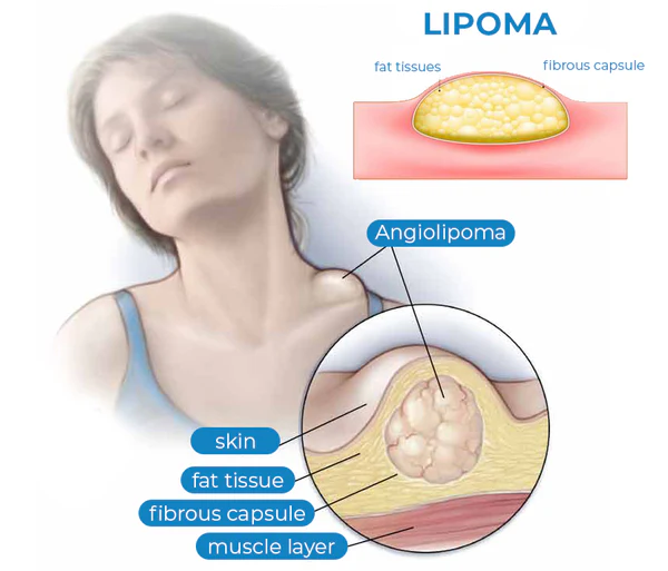 Diagnostic procedure