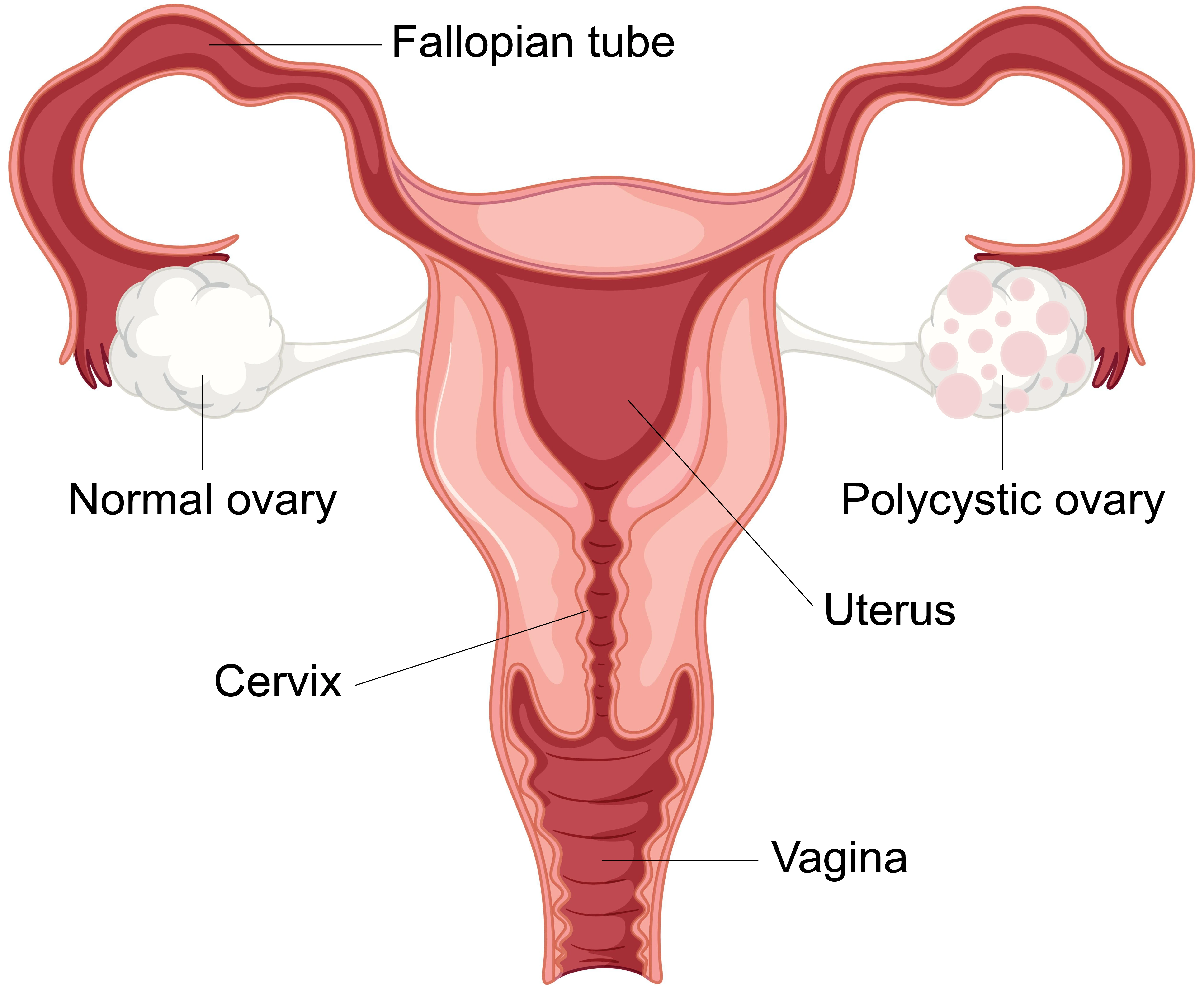 Condition illustration