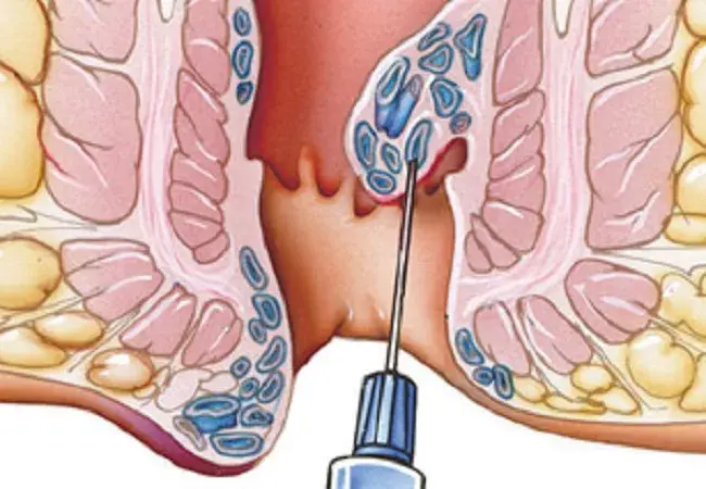 Condition illustration