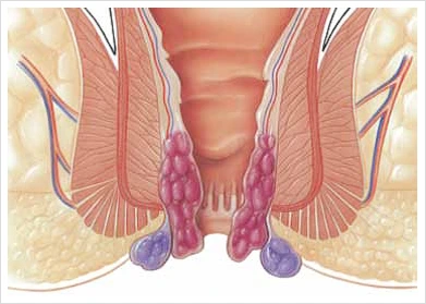 Diagnostic procedure