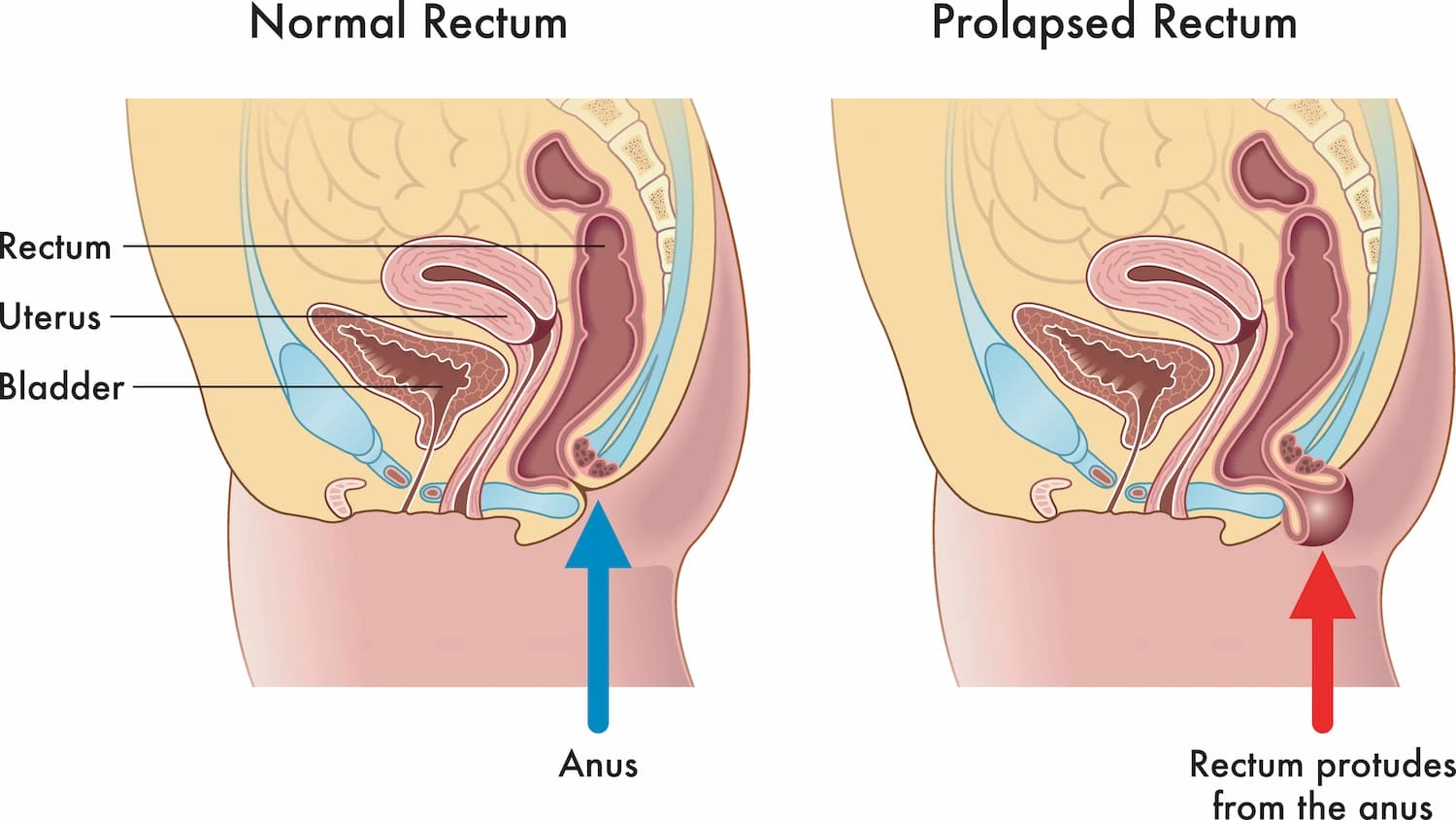 Diagnostic procedure