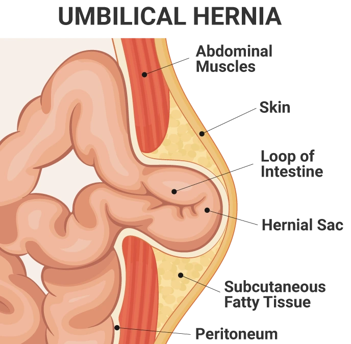 Condition illustration