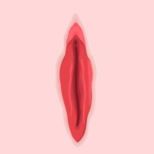 vaginoplasty